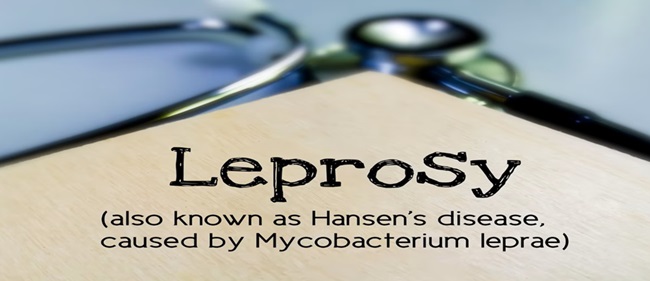 HANSEN-DISEASES