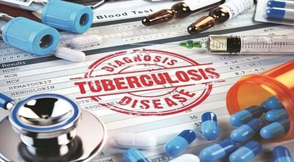 TB-cases