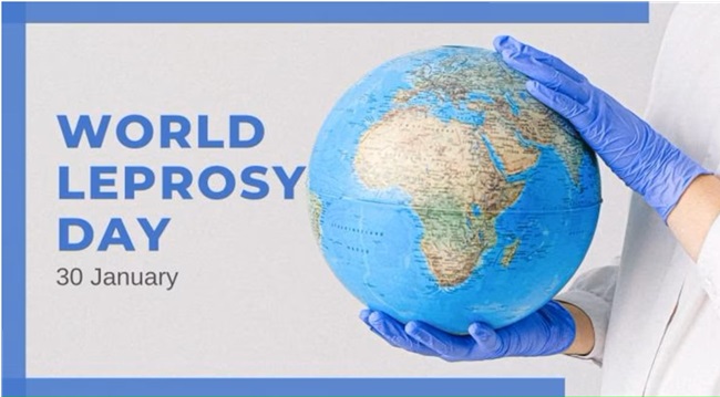 World-Leprosy-day