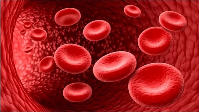 sickle-cell